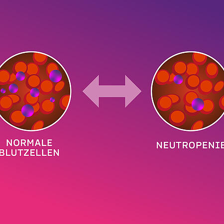 Abbildung zweier Blutgefäße, das eine ist gesund, das andere enthält wenige weiße Blutkörperchen